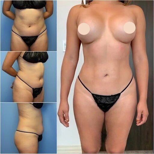 How Body Contouring in Dubai Enhances Confidence and Self-Esteem